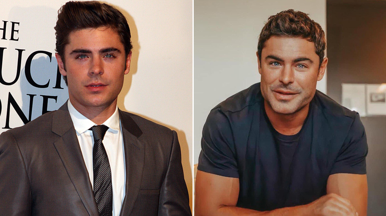 Calamardo Guapo ¿Qué le pasó a Zac Efron? Redes sociales hacen memes de su transformación